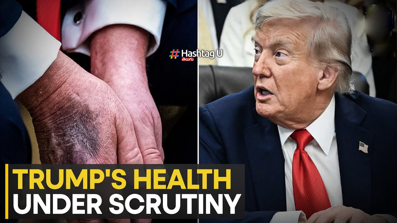 US President Trump Suffering From Alzheimer