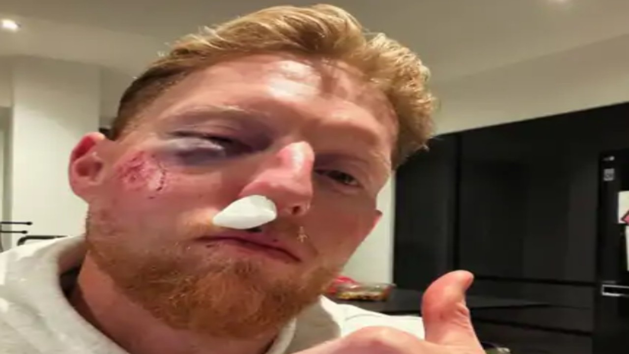 బెన్ స్టోక్స్‌కు ఘోర ప్రమాదం.. ముఖంపై బలమైన గాయం!