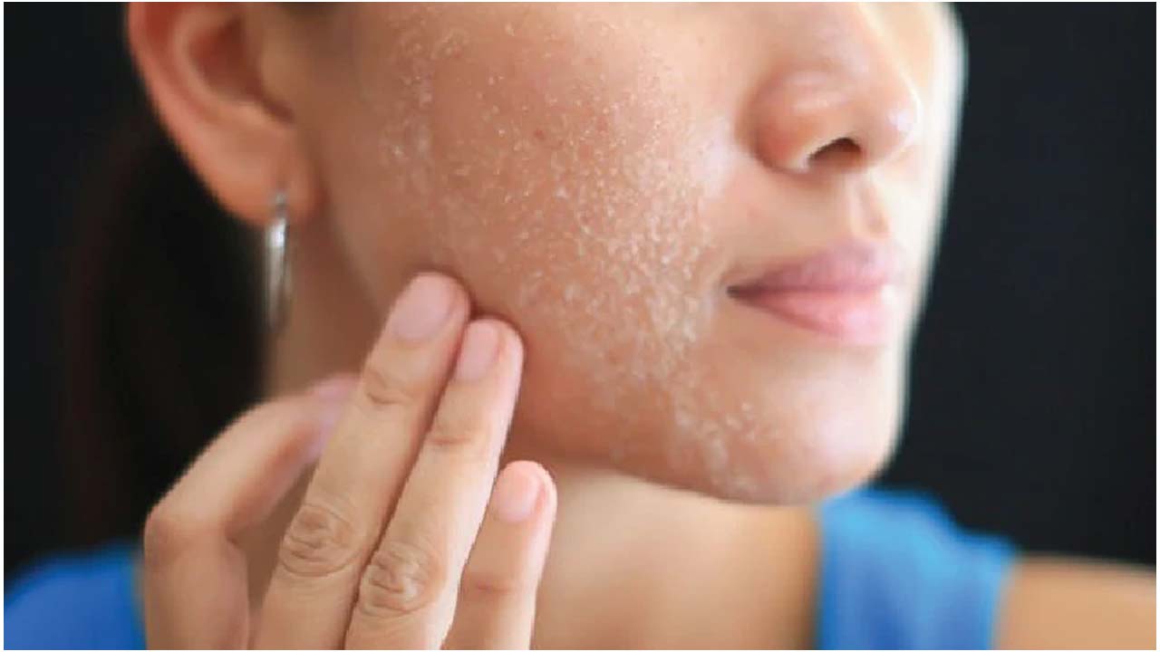 Dry Skin : మీరు పొడి చర్మం తో బాధపడుతున్నారా..? అయితే ఇలా చెయ్యండి !