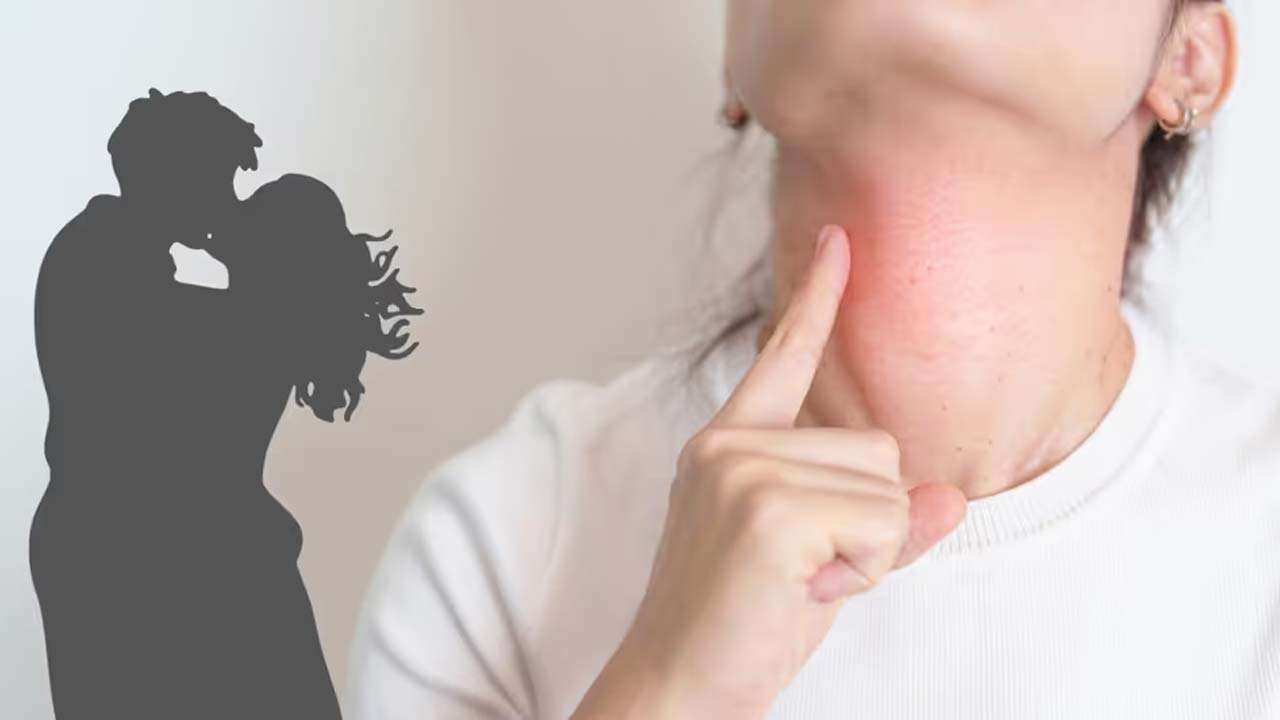 Kissing Disease :  ‘కిస్సింగ్ డిసీజ్’ ను నిర్లక్ష్యం చేస్తే పెను ప్రమాదం