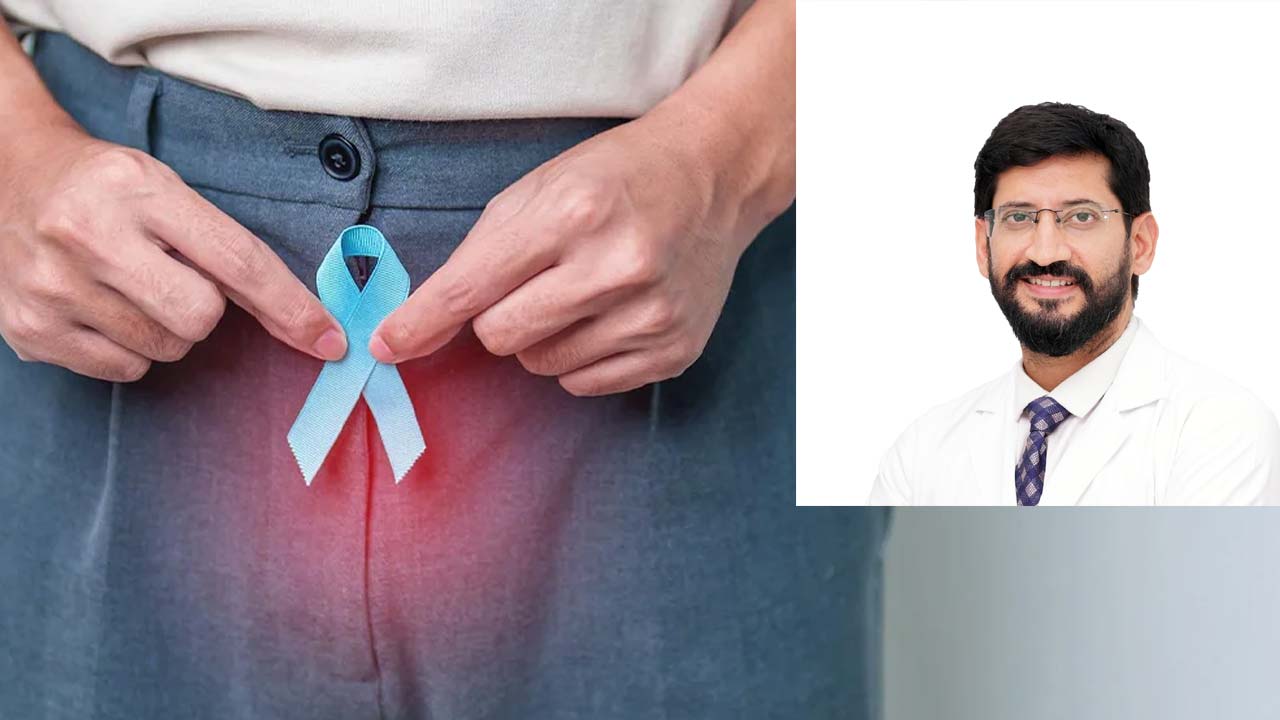 Prostate Cancer