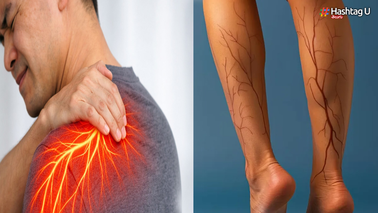 Are you troubled by nerve weakness