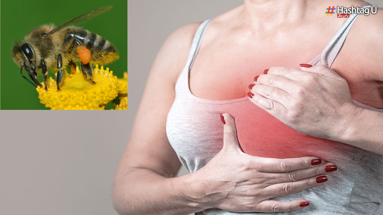 Breast Cancer: తేనెటీగల విషంతో బ్రెస్ట్ క్యాన్సర్కు చికిత్స…?