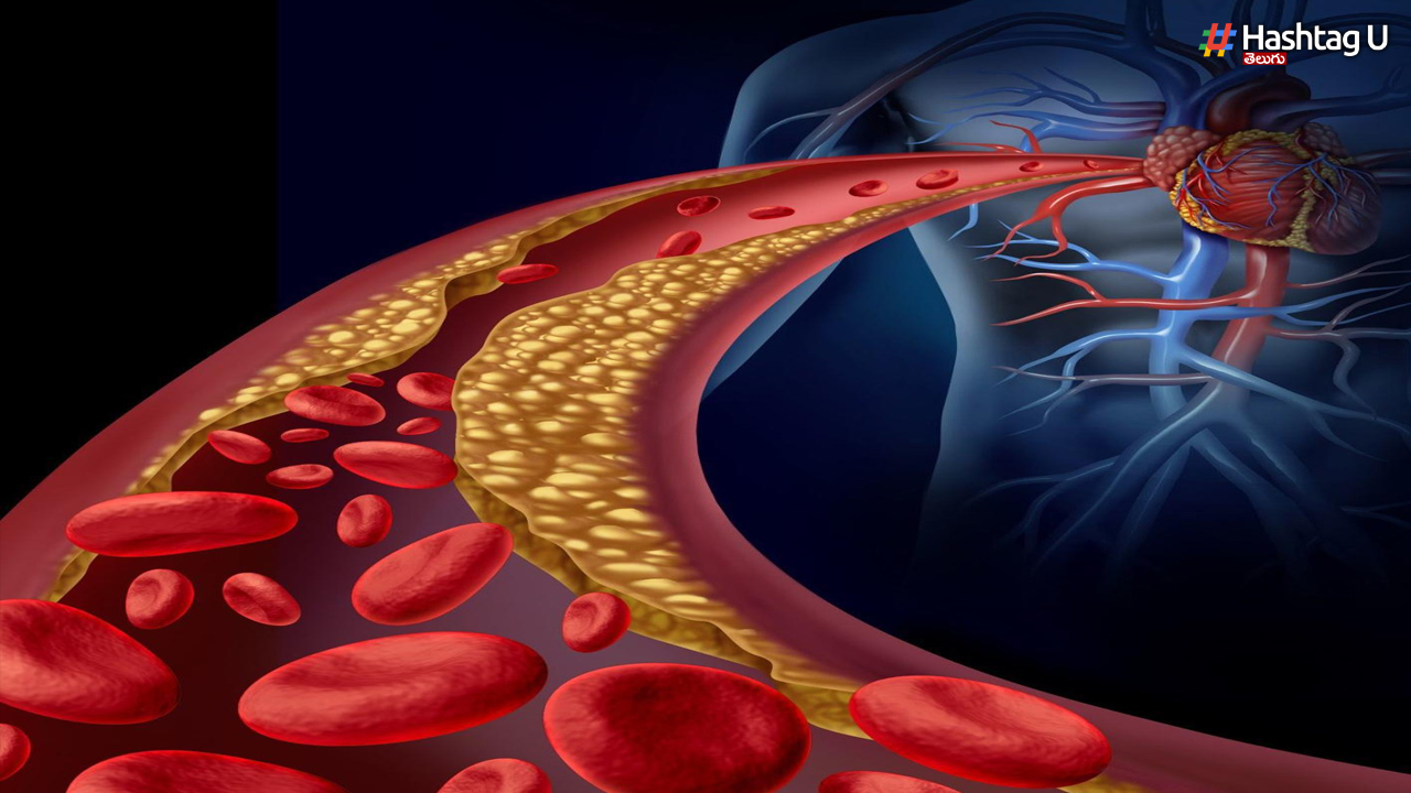 Cholesterol is essential for our body... but when does it become life-threatening?