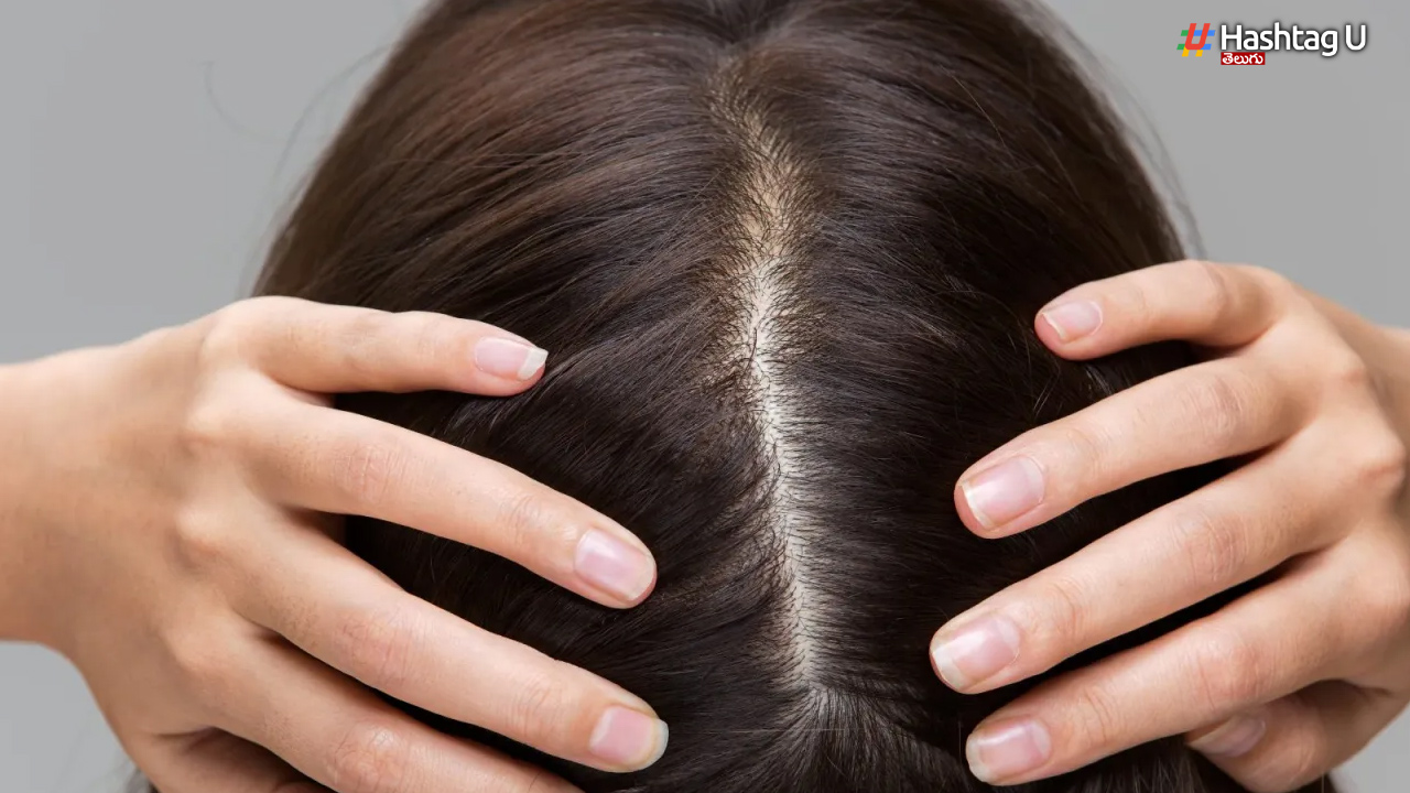 Thin Hair: జుట్టు పలచబడిందా..? ఈ చిట్కాలు పాటించి చూడండి..!!