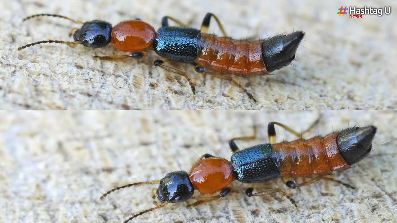 Paederus Beetles: అమ్మో ఏపీని వణికిస్తున్న యాసిడ్‌ పురుగులు..